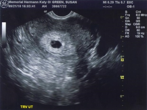 6 недель от зачатия беременности что происходит